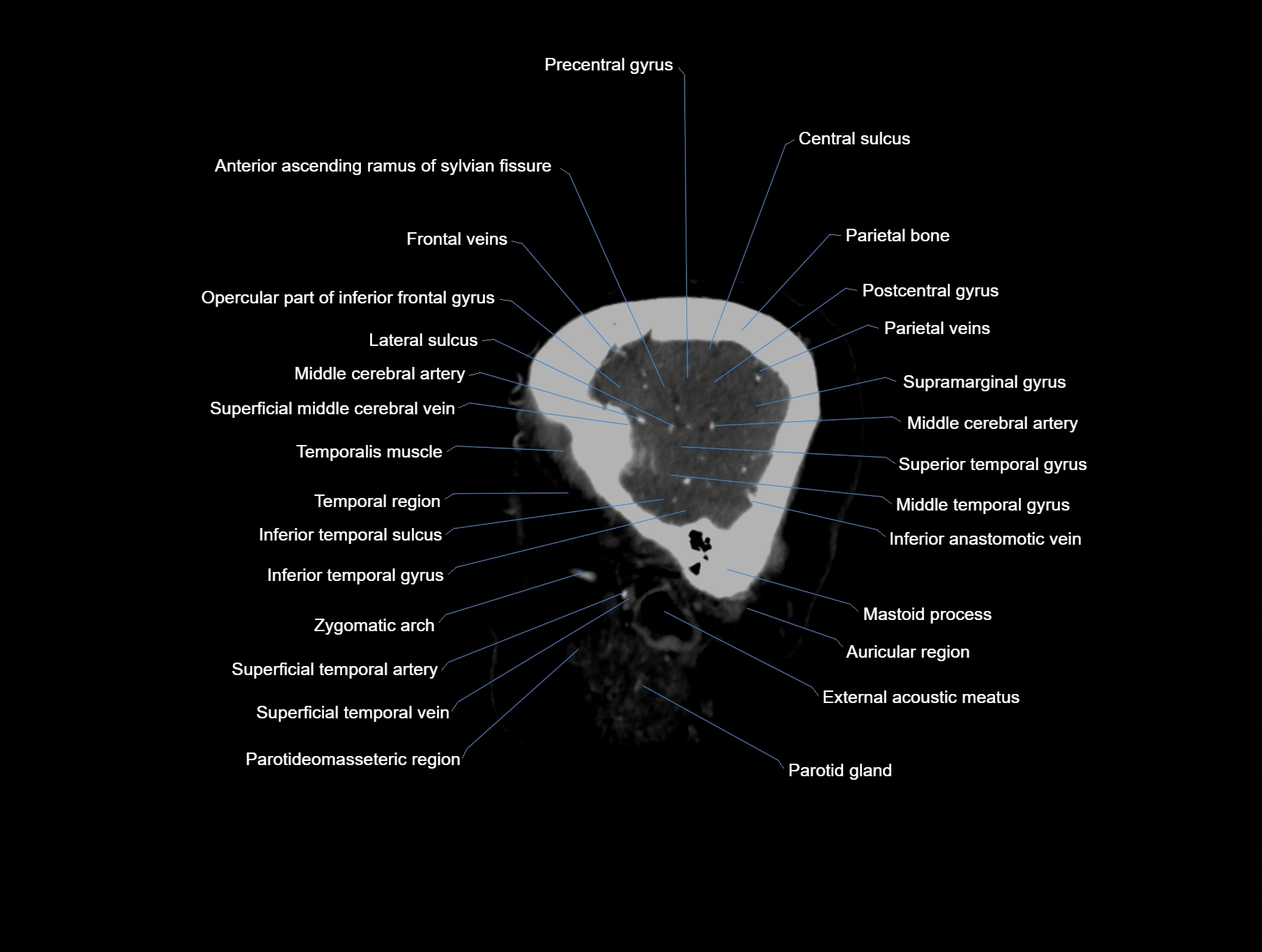 CT scan brain sagittal cross sectional anatomy image-img-00001-00008.webp